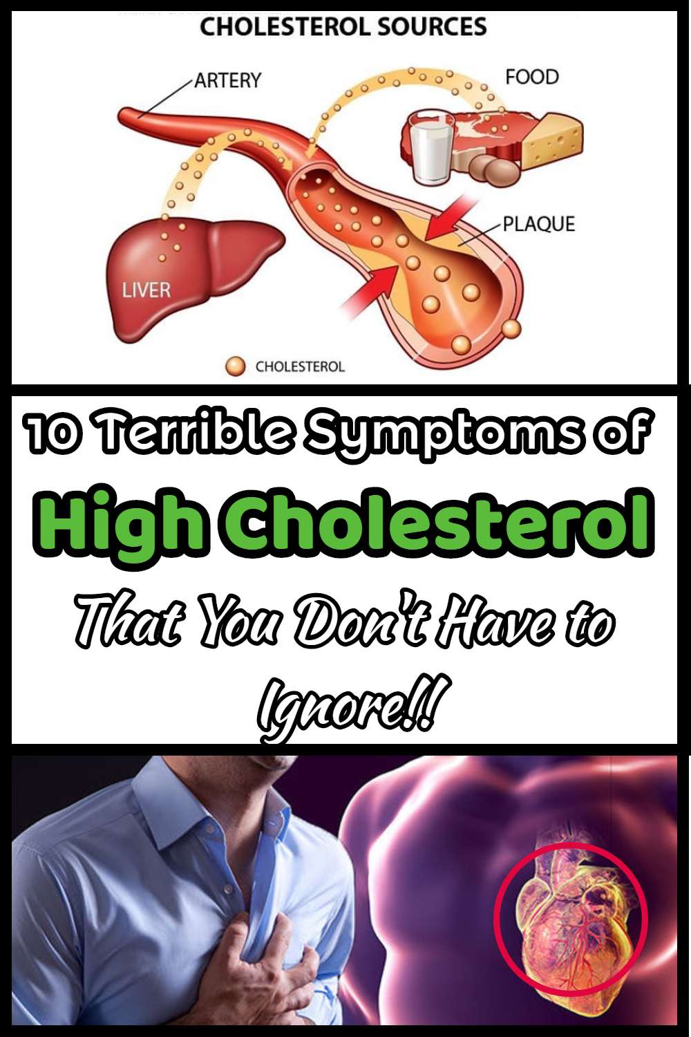 10 Terrible Symptoms of High Cholesterol That You Don