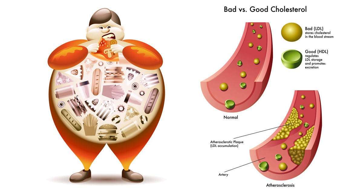 7 Natural Ways To Lower Cholesterol Levels Fast