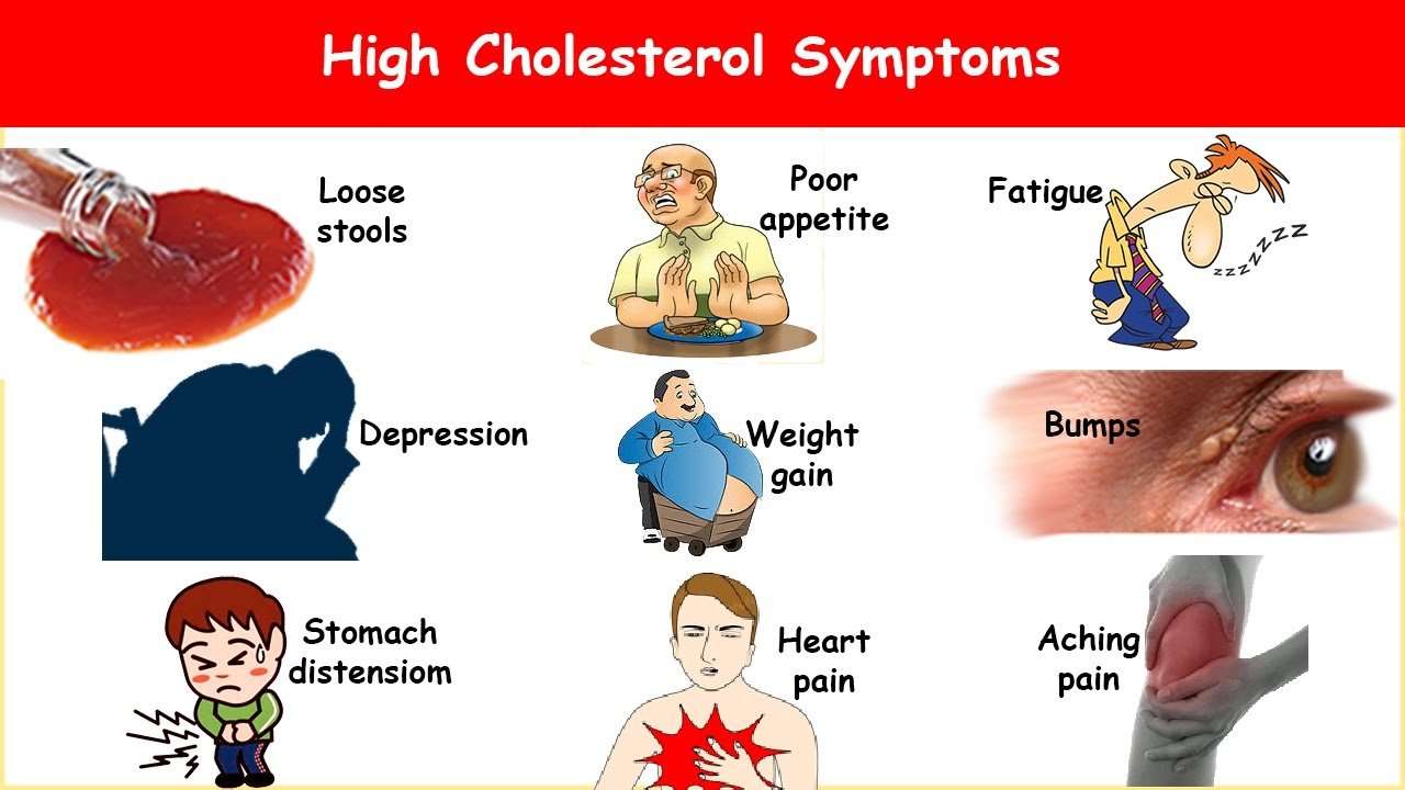 9 High Cholesterol Symptoms! What are High Cholesterol ...