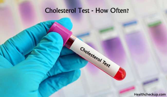 Cholesterol Check up &  Tests involved in Cholesterol Check up