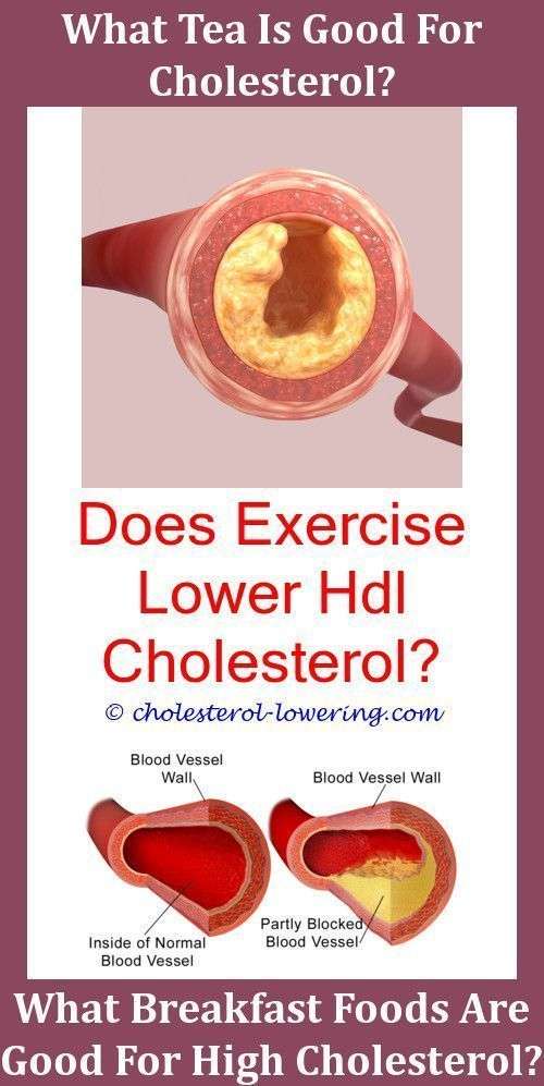 Cholesterollevels What Should My Cholesterol Be For My Age ...