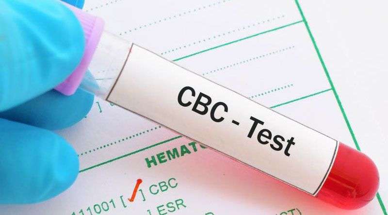 Complete Blood Count Test, CBC Blood Test in Delhi, NCR ...