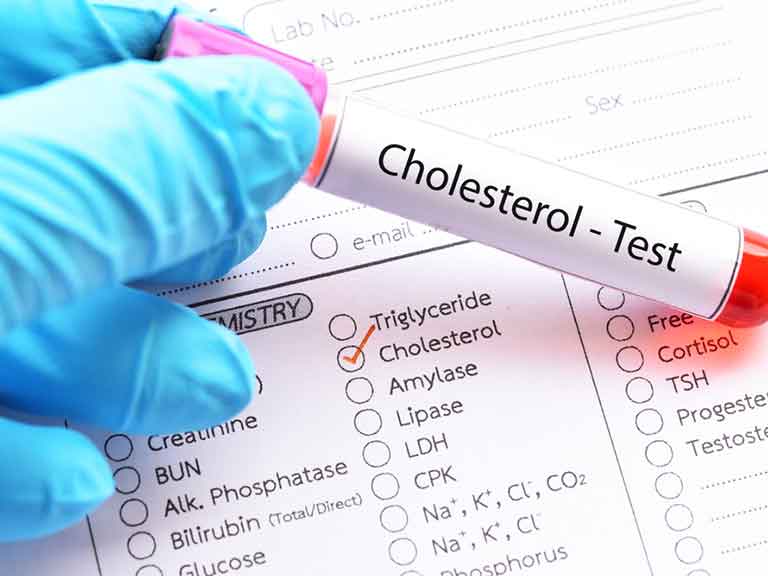 Do I need to fast before a cholesterol test?