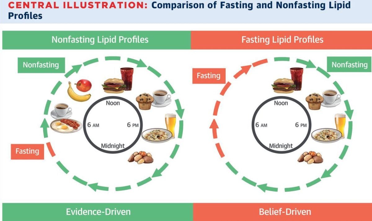 Do You Need To Fast Before Your Cholesterol Test?
