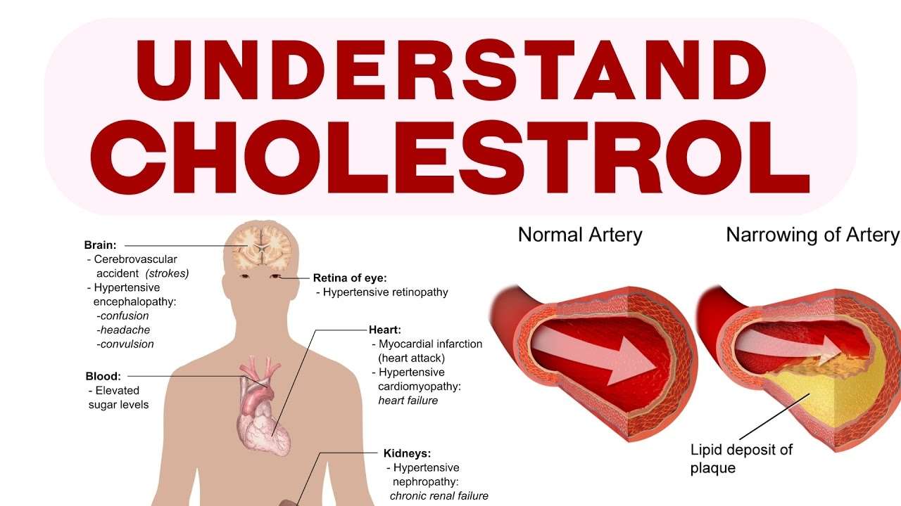 Does Past Have Cholesterol : Everything You Need To Know About High ...