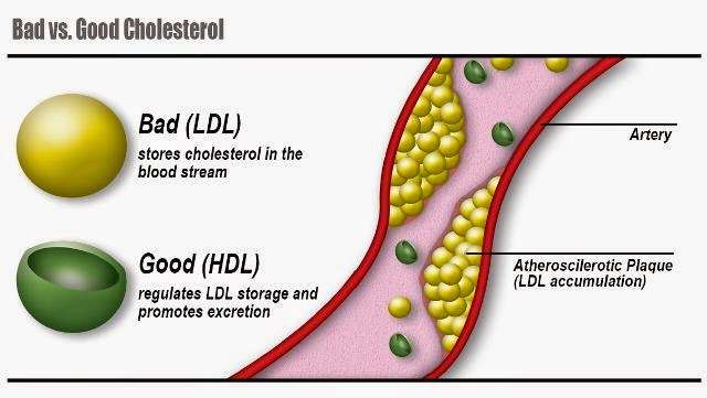 Dr. Liverman/ Improving Metabolic Health : Preventing Atherosclerosis ...