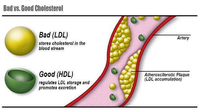 HDL and LDL. Do you know the difference?