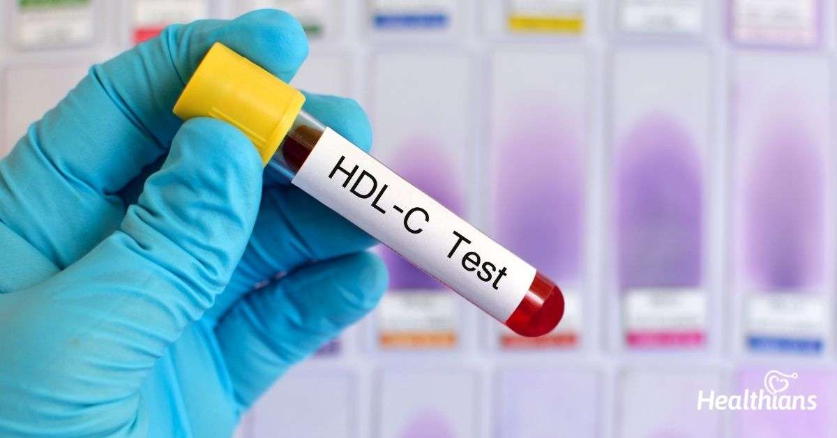 HDL Cholesterol Test