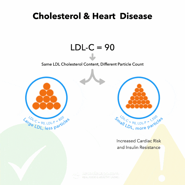 High Cholesterol on a Keto Diet