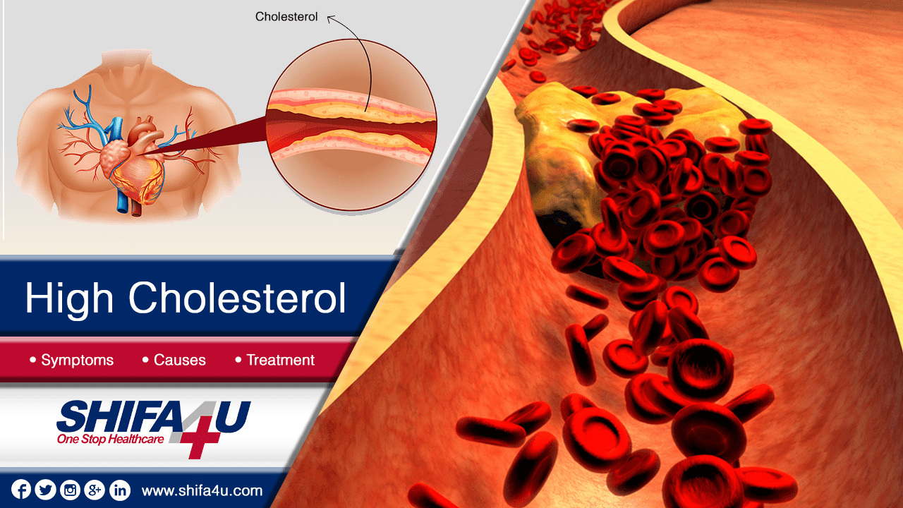 High Cholesterol : Symptoms