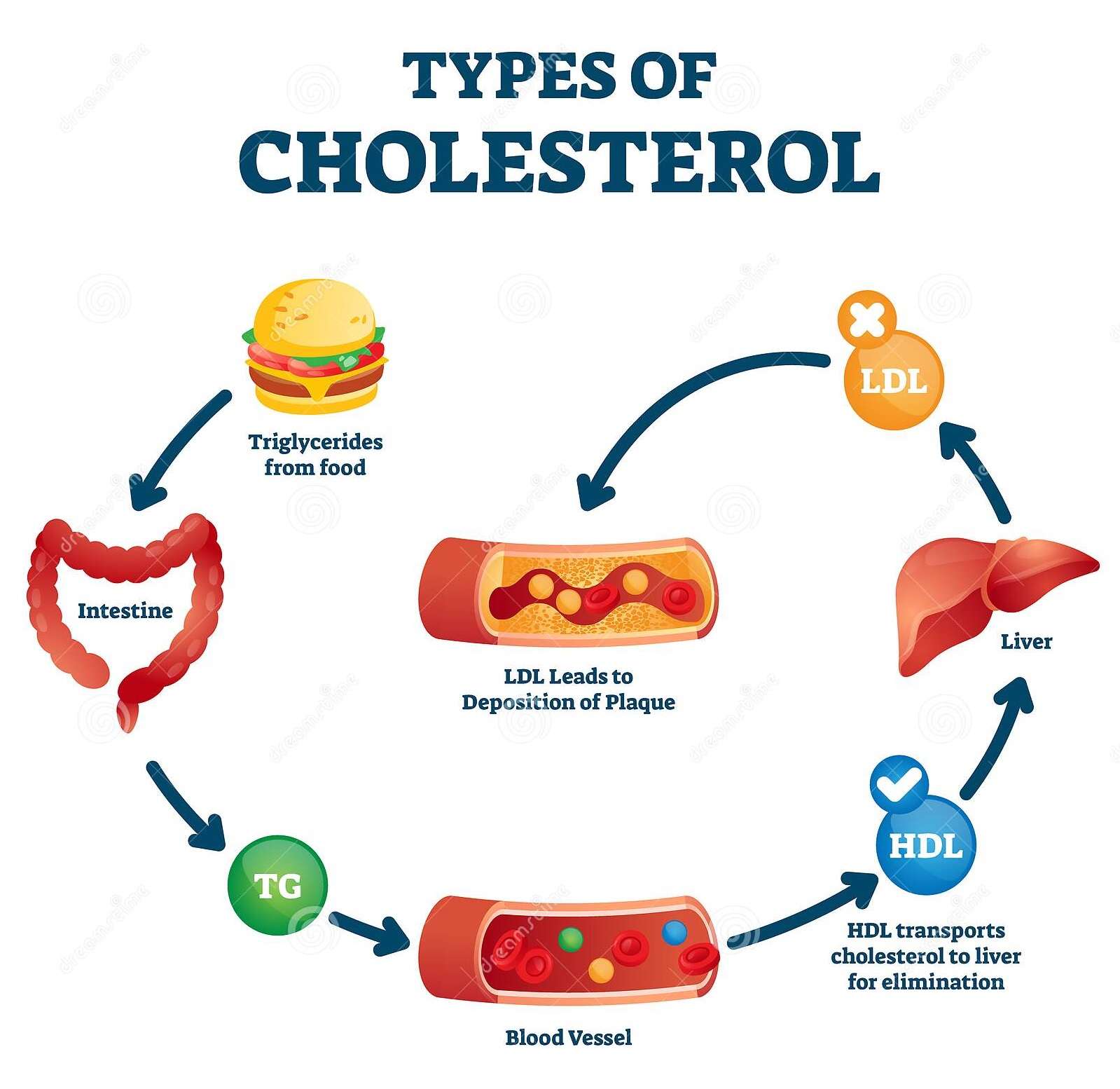 High Cholesterol, What Is Cholesterol  Everything We Need To Know About
