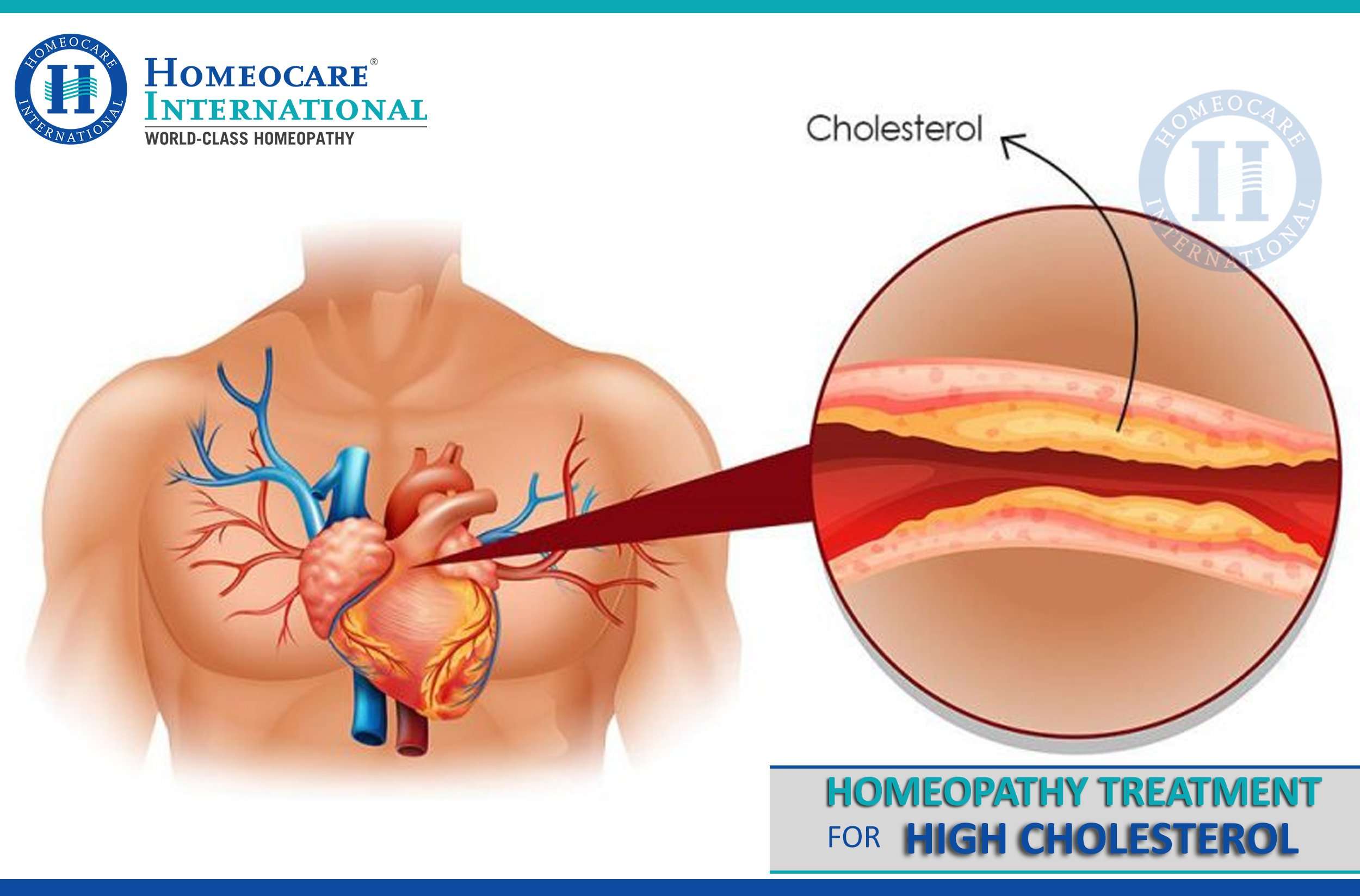 Homeopathy Treatment for High Cholesterol
