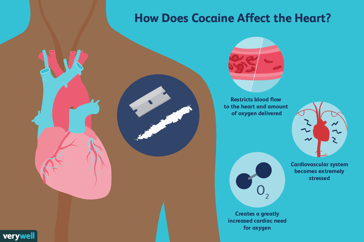 How Cocaine Affects the Cardiovascular System