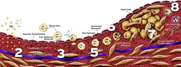 How long does it take for our arteries to clear up from ...