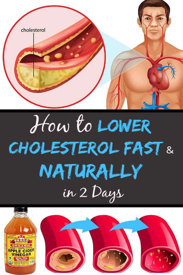How to Lower Cholesterol Level Fast &  Naturally