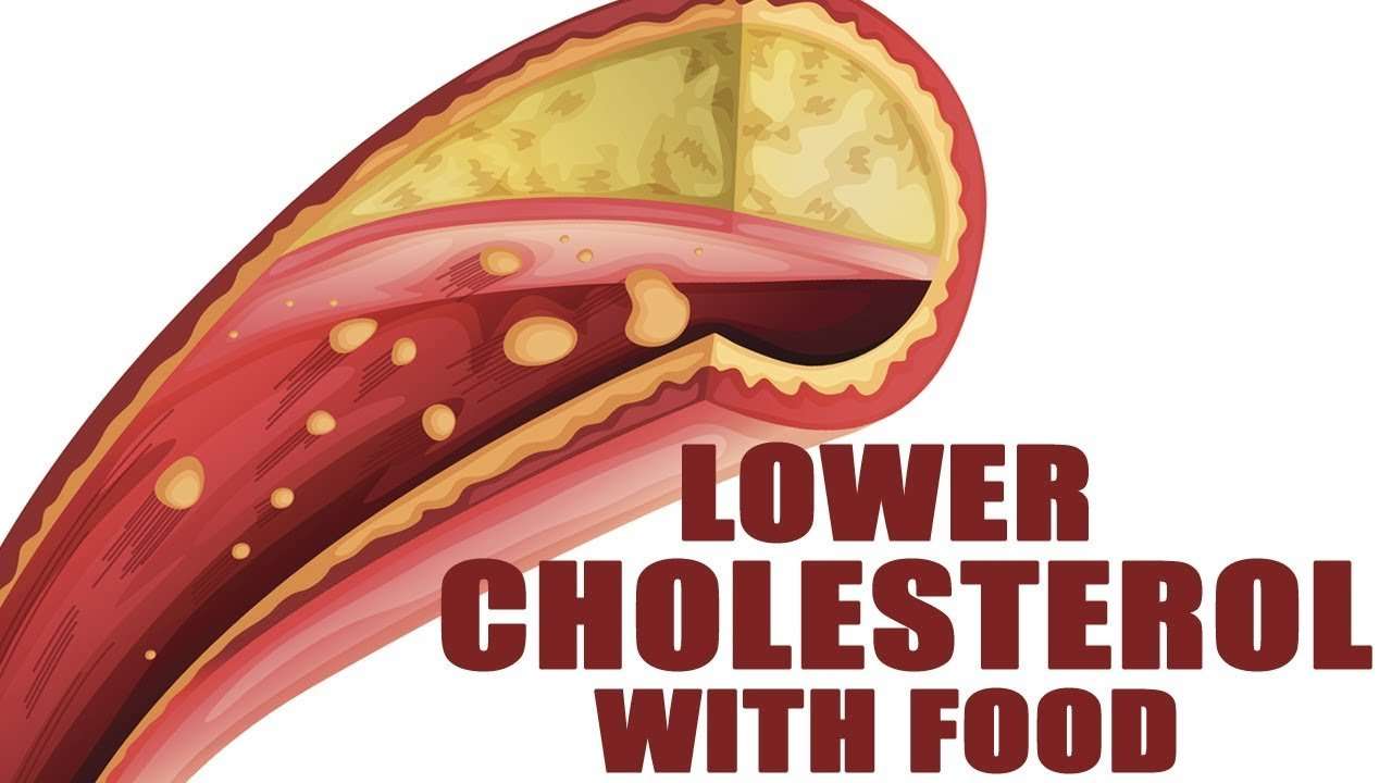 How To Lower Cholesterol Naturally In 1 Month