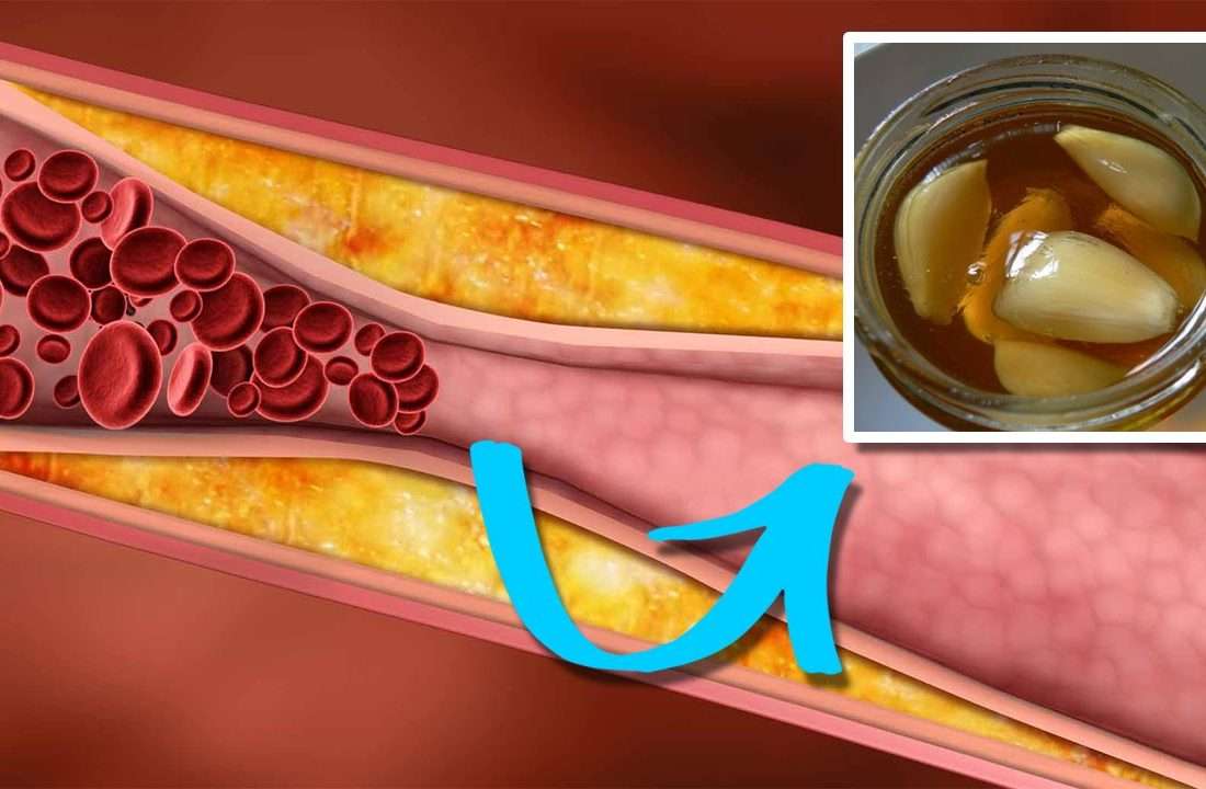How to lower triglycerides