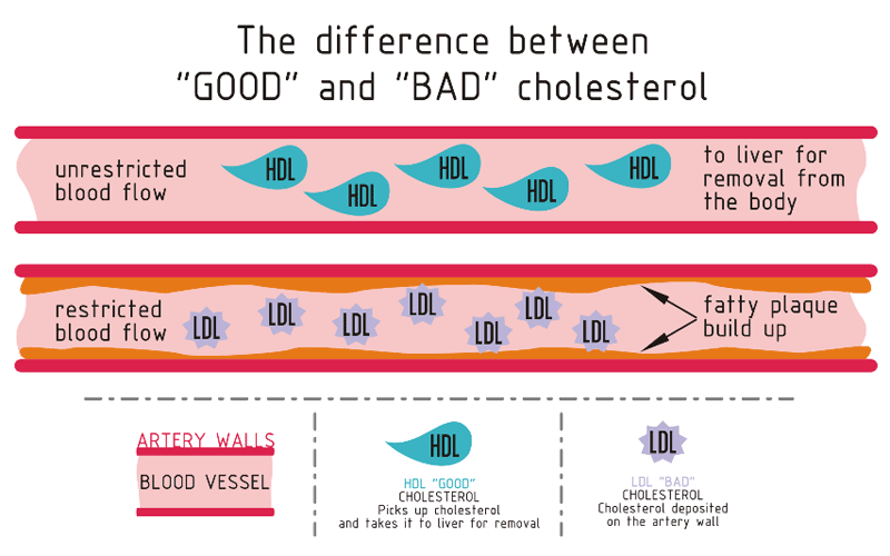 How To Read A Cholesterol Blood level Test ?