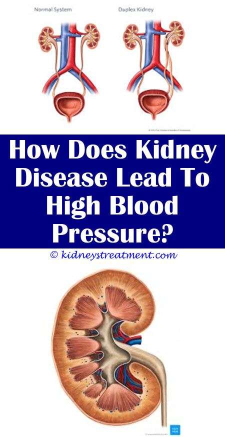 Kidney Stones Cause High Blood Sugar