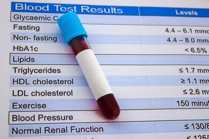 Making sense of cholesterol tests