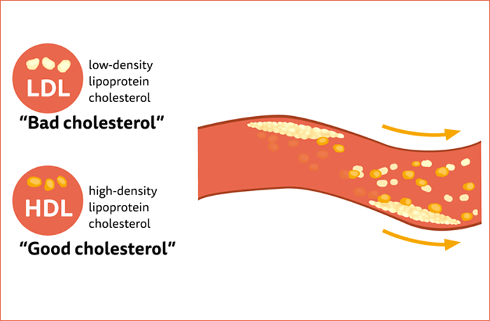 Scientific concept: good vs. bad cholesterol