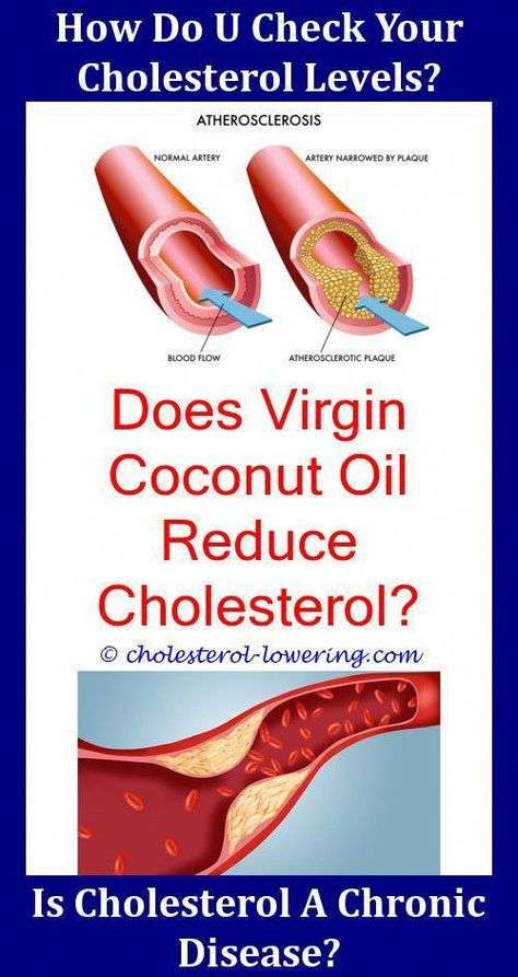 Should I Take Statins To Lower Cholesterol?,is total ...