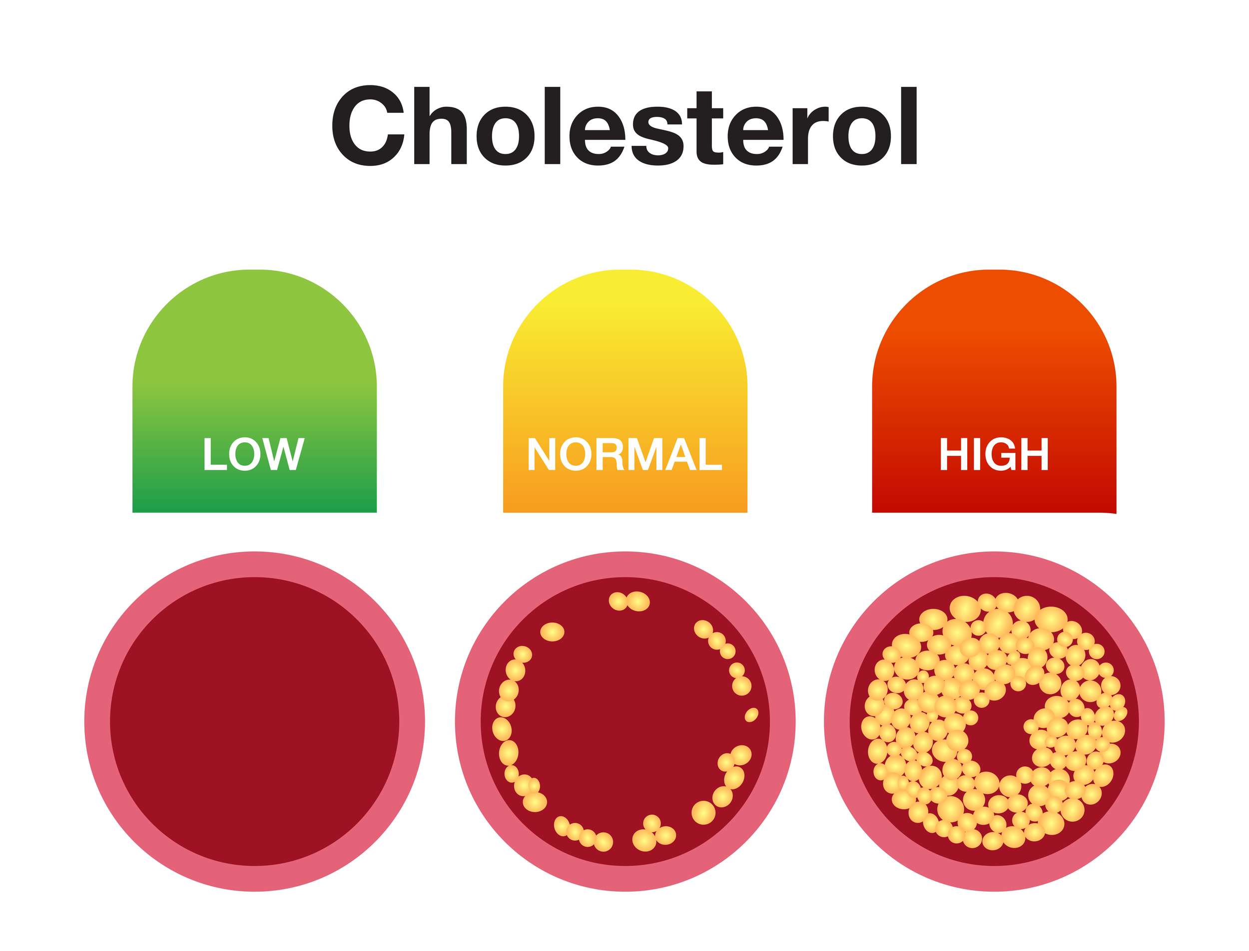The Good And Bad Of Cholesterol