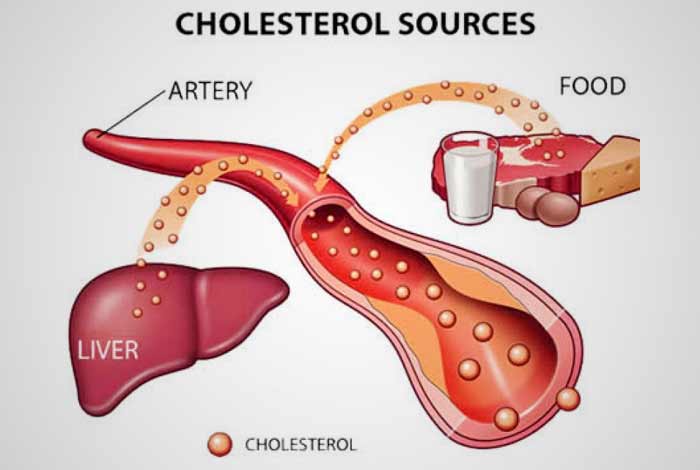 The Link Between Liver and Cholesterol Explained