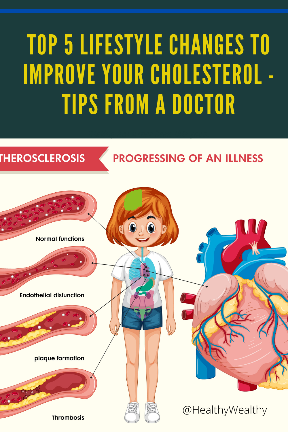 Top 5 lifestyle changes to improve your cholesterol