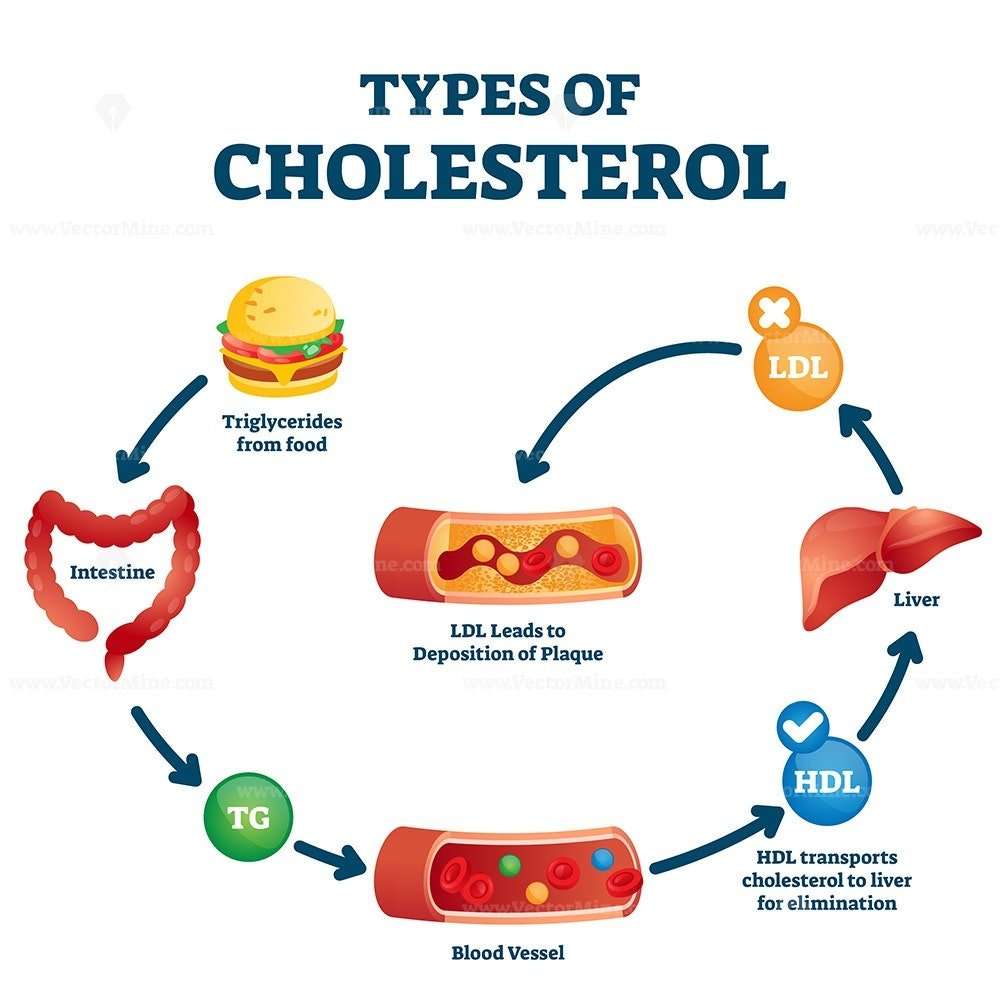 Types of cholesterol educational cycle scheme from fatty ...