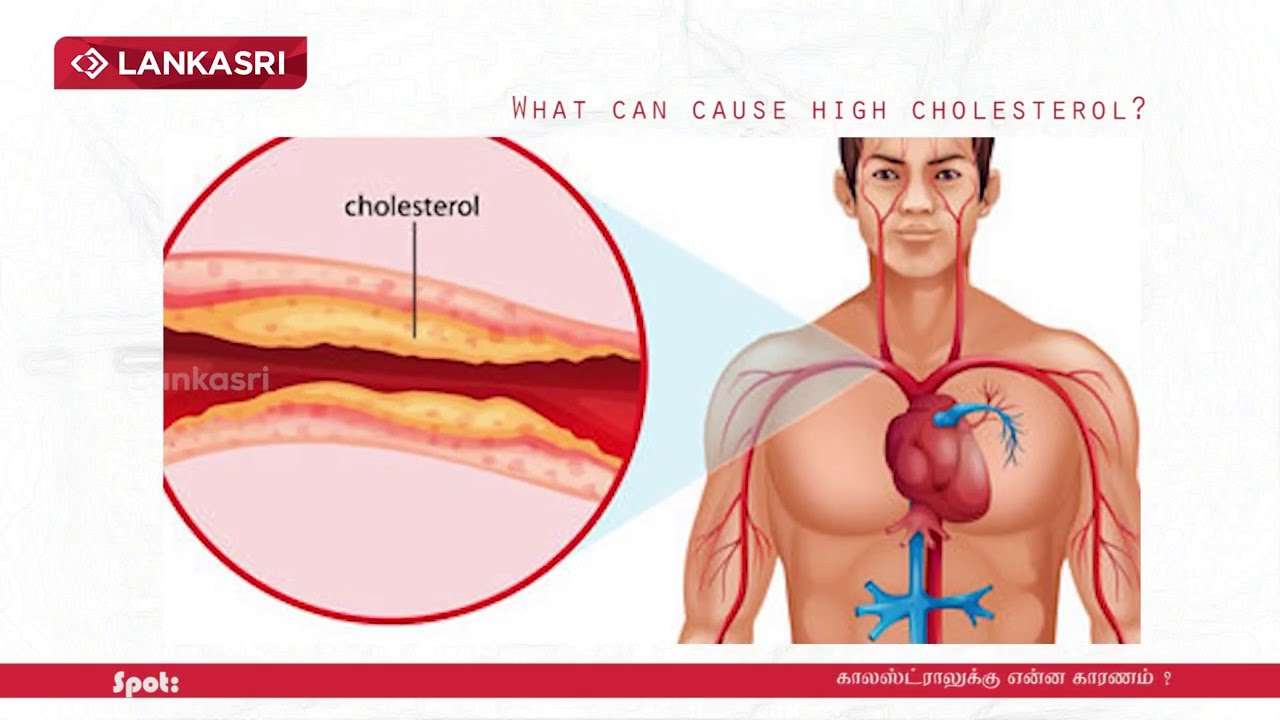 What can cause high cholesterol ?