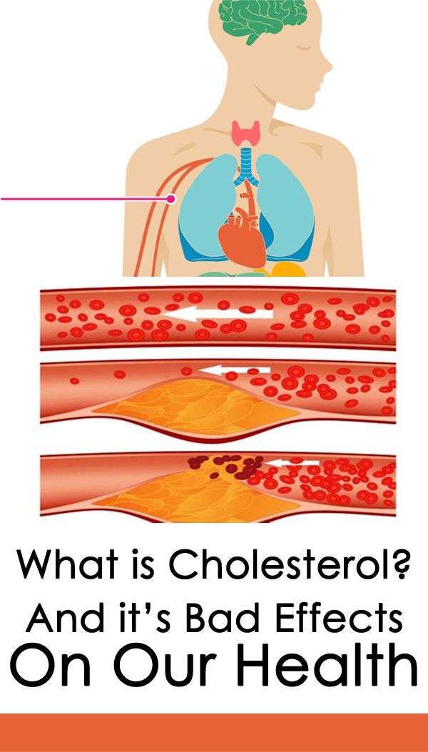 What is Cholesterol? And itâs Bad Effects on our Health in 2020