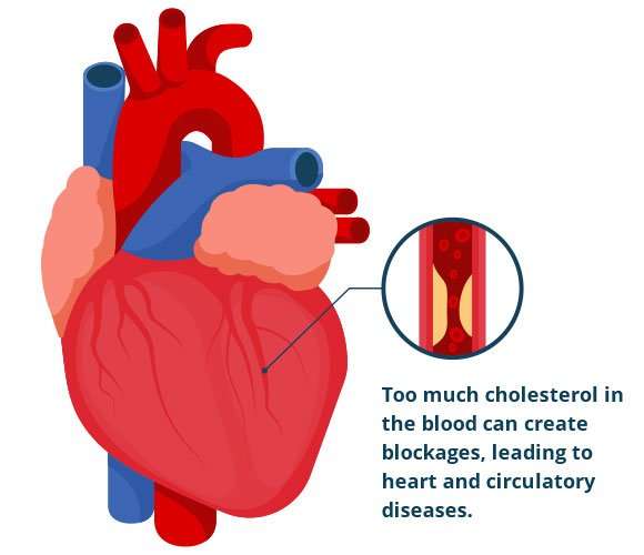 What is High Cholesterol?