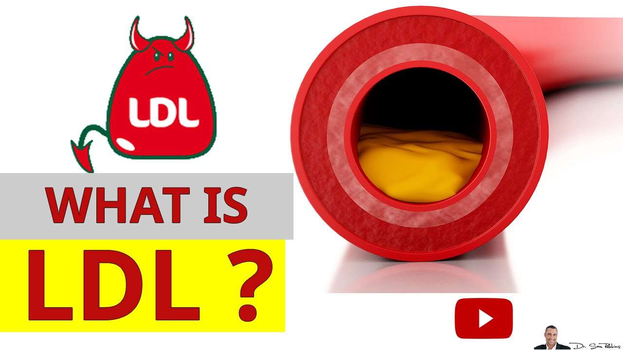 What Is LDL Cholesterol And Why Its Called The BAD ...