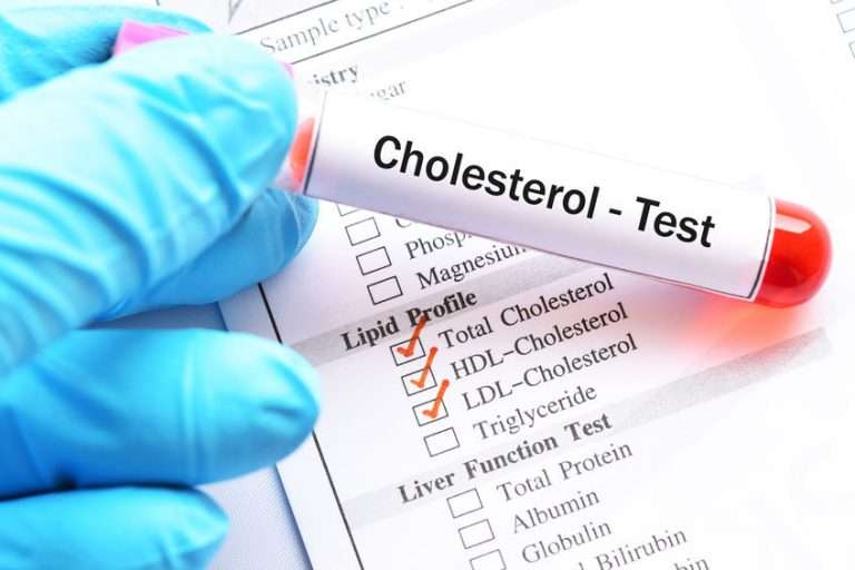 Why Cholesterol Test is So Important for Every Person in ...