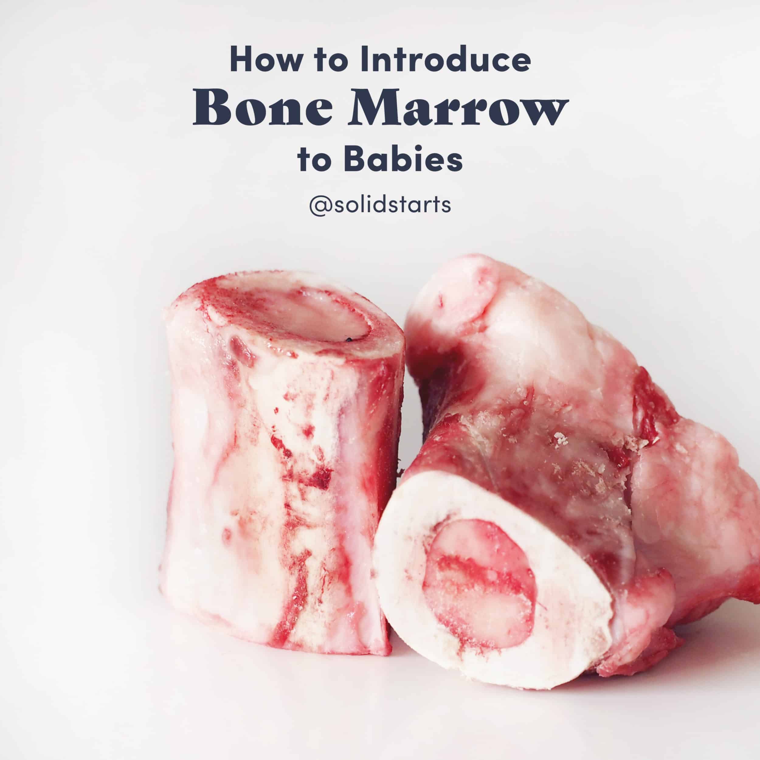 Why You Should Give Your Baby Bone Marrow